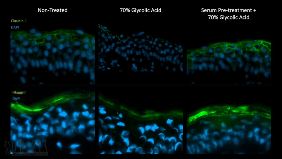 3 70% 乙醇酸剥脱项目前使用和未使用浓缩精华的体外皮肤对比.png