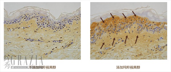 图三 纯粹视黄醇促进透明质酸（玻尿酸）明显增加，有效提升肌肤水润度.png
