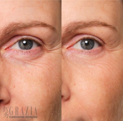 nqhur20260317015437.jpg 11.jpg